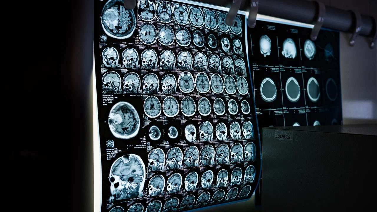 Radiologo robotico basato su IA per aiutare nelle diagnosi